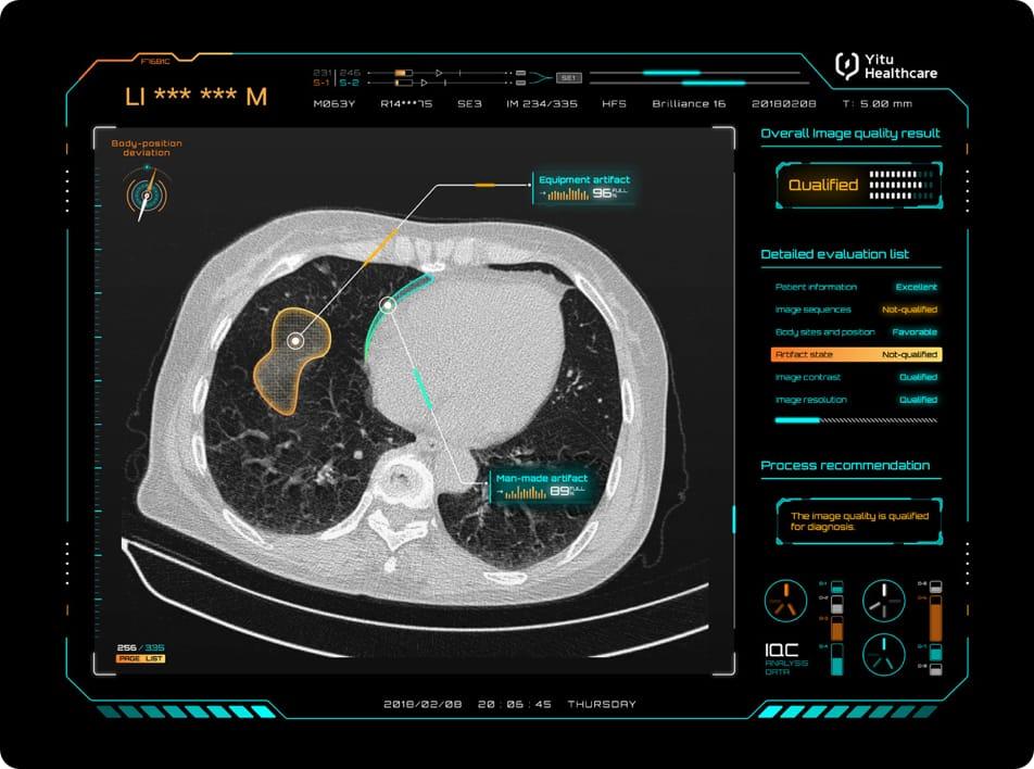 care.aiTM 智能多模態(tài)影像質(zhì)控系統(tǒng)